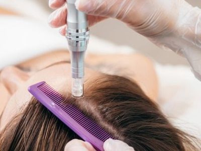 Jeune femme blonde avec un problème de perte de cheveux recevant une injection, gros plan _ Photo Premium